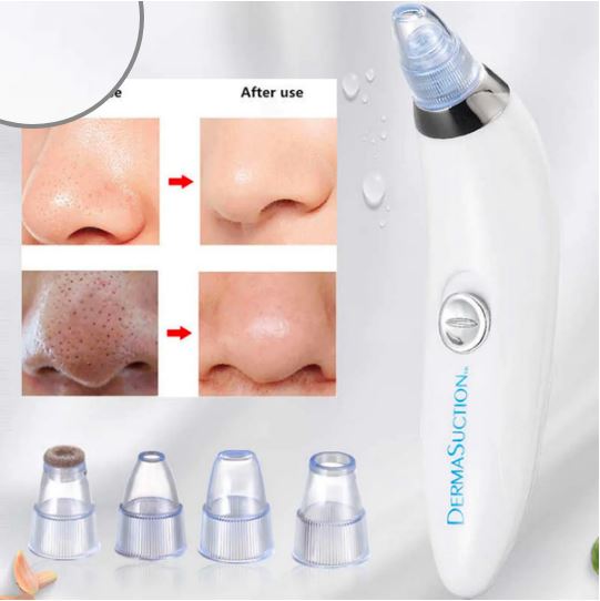 Derma Suction Blackhead Remover Device